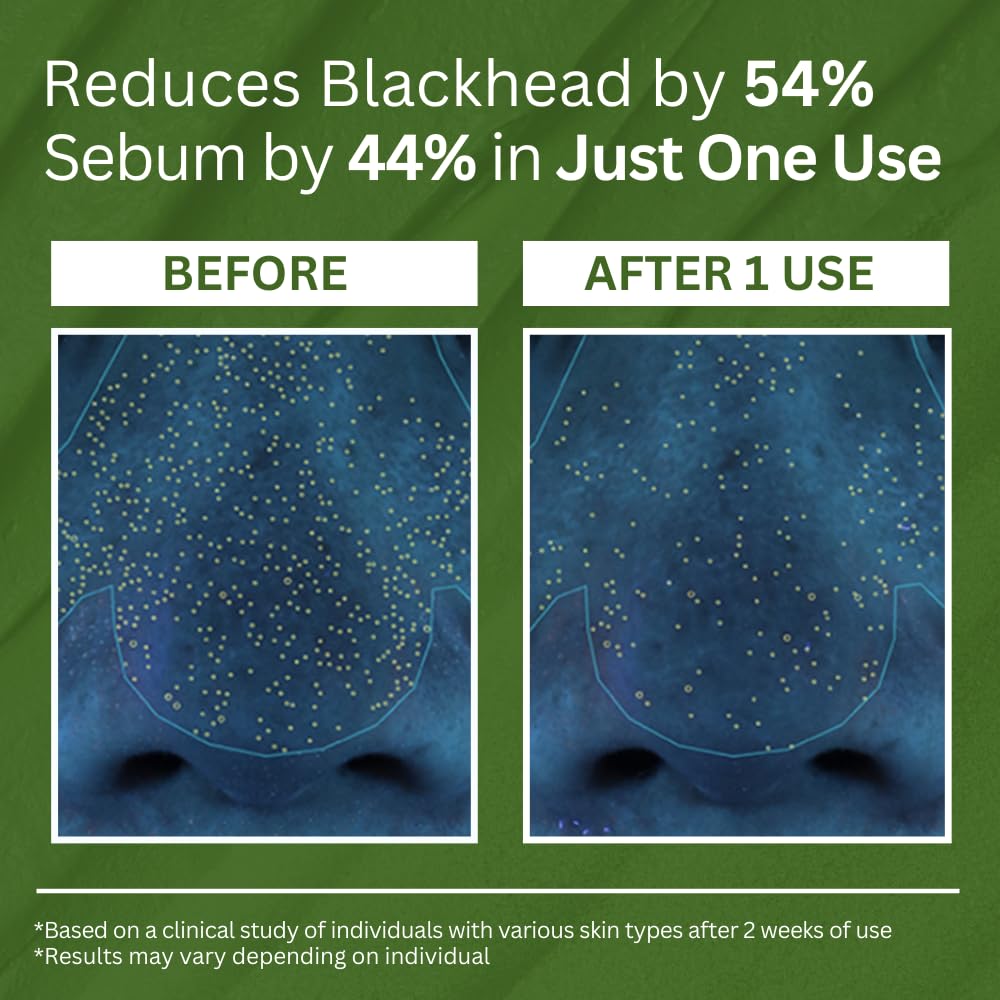 P.CALM Holy Basil Bubble Deep Mask β 90g Sparkling Bubble Detox with Holy Basil + PHA