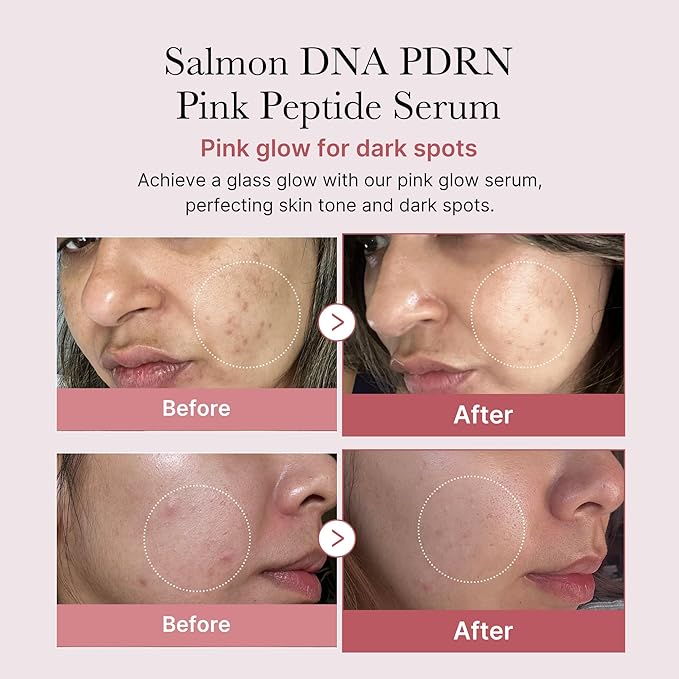 medicube PDRN Pink Peptide Ampoule 30ml